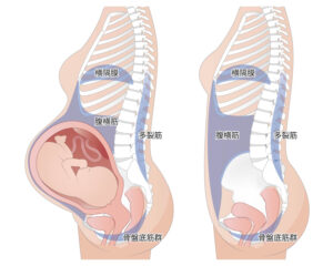 妊婦さんを横からのお腹を見た構造図