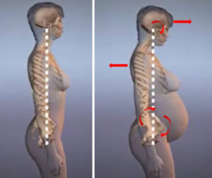 妊婦の横からみた姿勢の変化