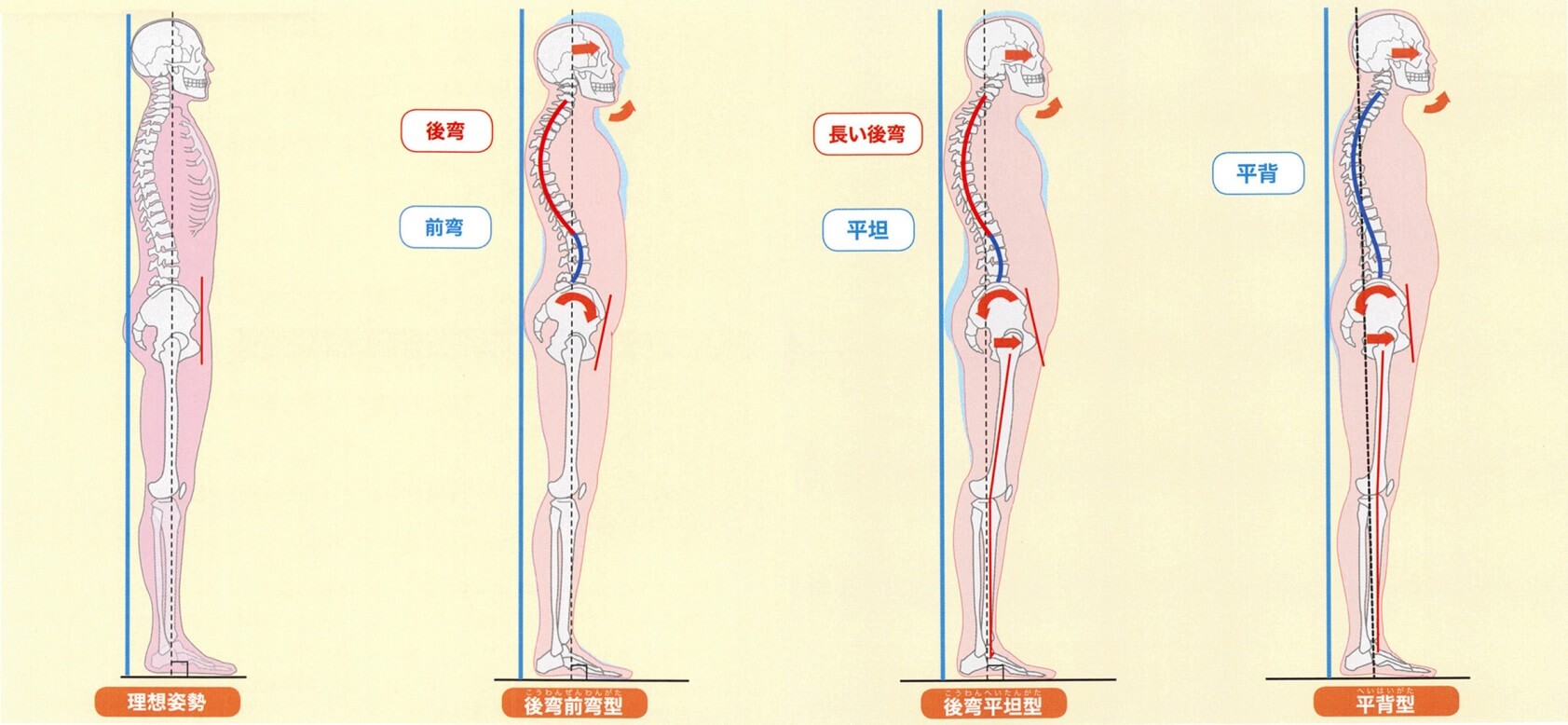 不良姿勢