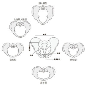 骨盤分類