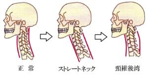 頚椎のカーブ
